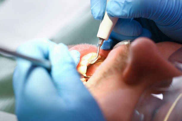 Best Emergency Dental Filling Replacement  in Felton, DE